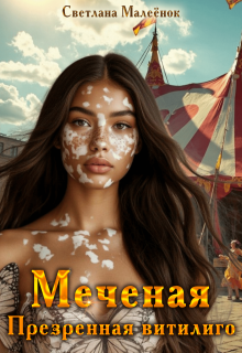 Меченая. Презренная витилиго. (Светлана Малеёнок)